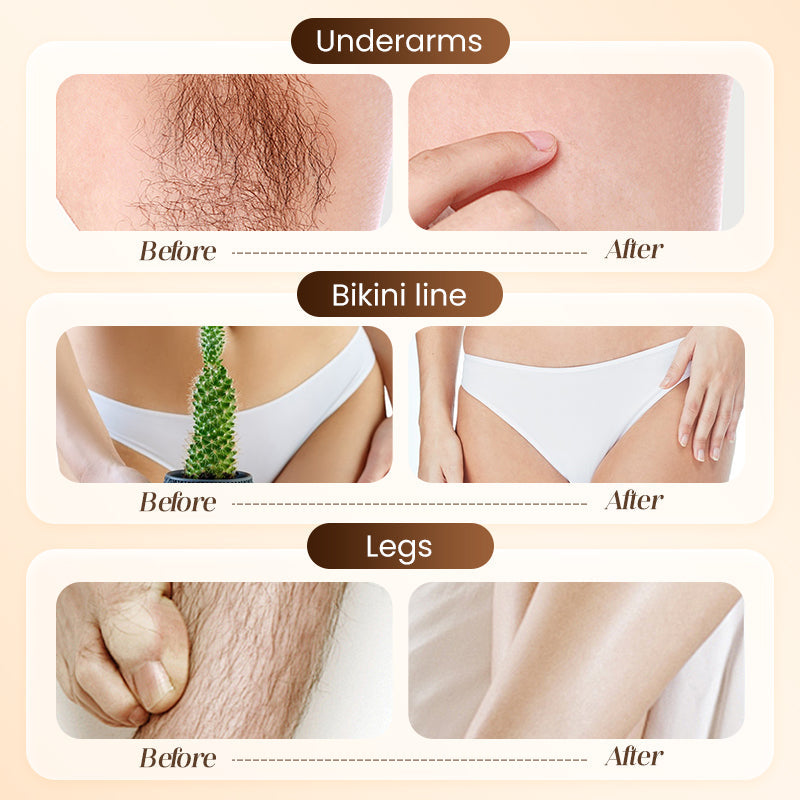 LAST DAY BUY 1 GET 1 FREE💞Bikini Hair Removal Cream for Sensitive Skin | Suitable for Men & Women |